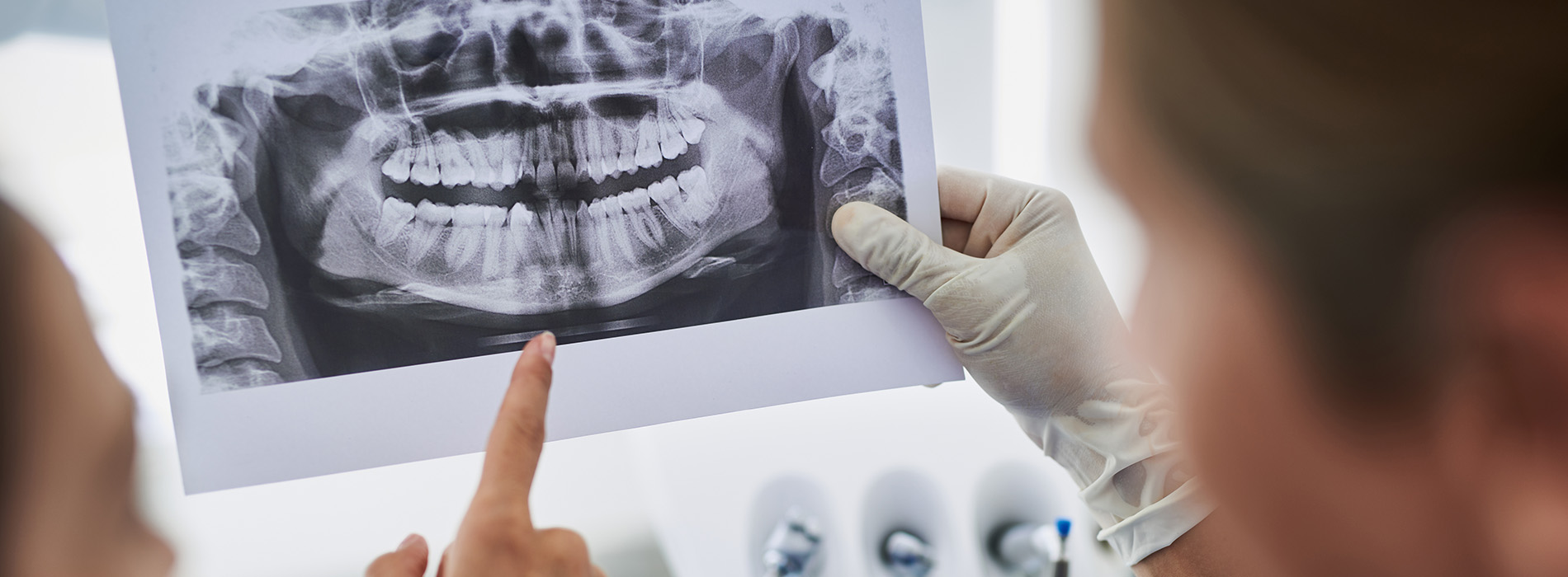 An individual points at a dental x-ray, possibly explaining a dental issue to another person.